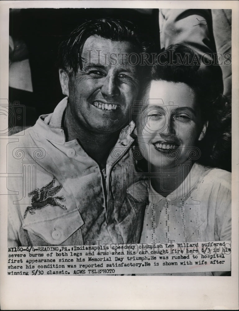 Press Photo Lee Willard and wife. He suffered severe burns on legs. - nes15011 - Historic Images