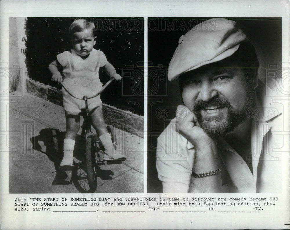 1985 Press Photo Dom Deluise Comedian Television- Historic Images