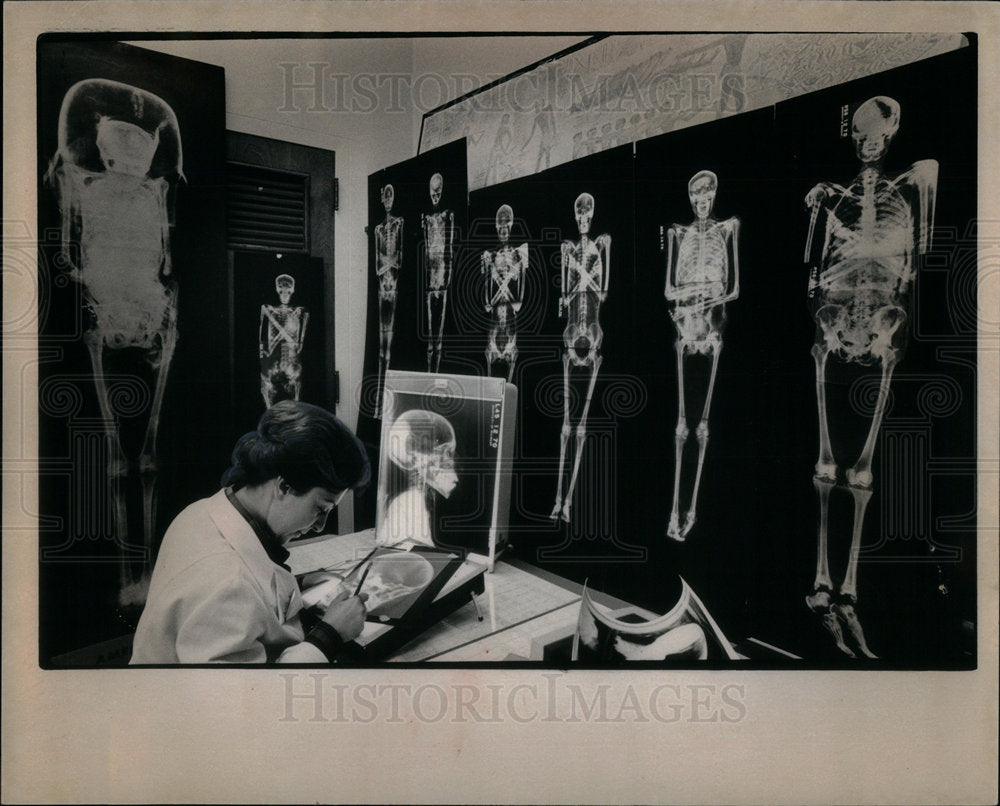 1975 Press Photo Manigeh Askarieh dentist Michigan- Historic Images