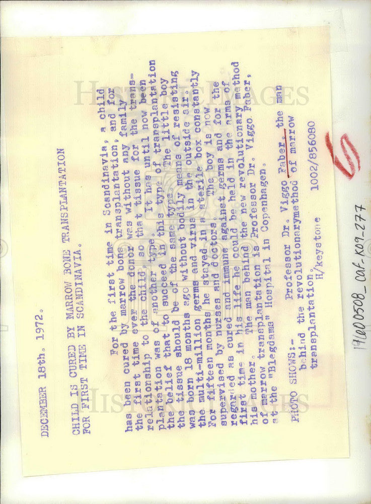 1972 Press Photo Dr Viggo Faber, Marrow Transplantation - KSB09537