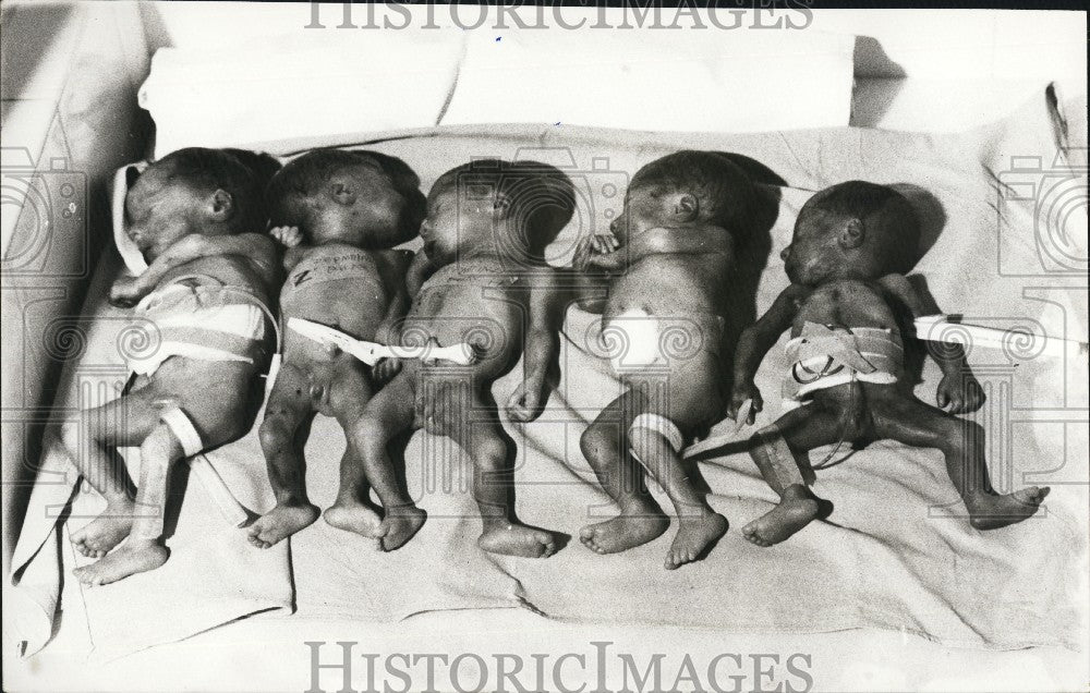 Press Photo Five Infants Die Shortly After Their Birth - KSG05461