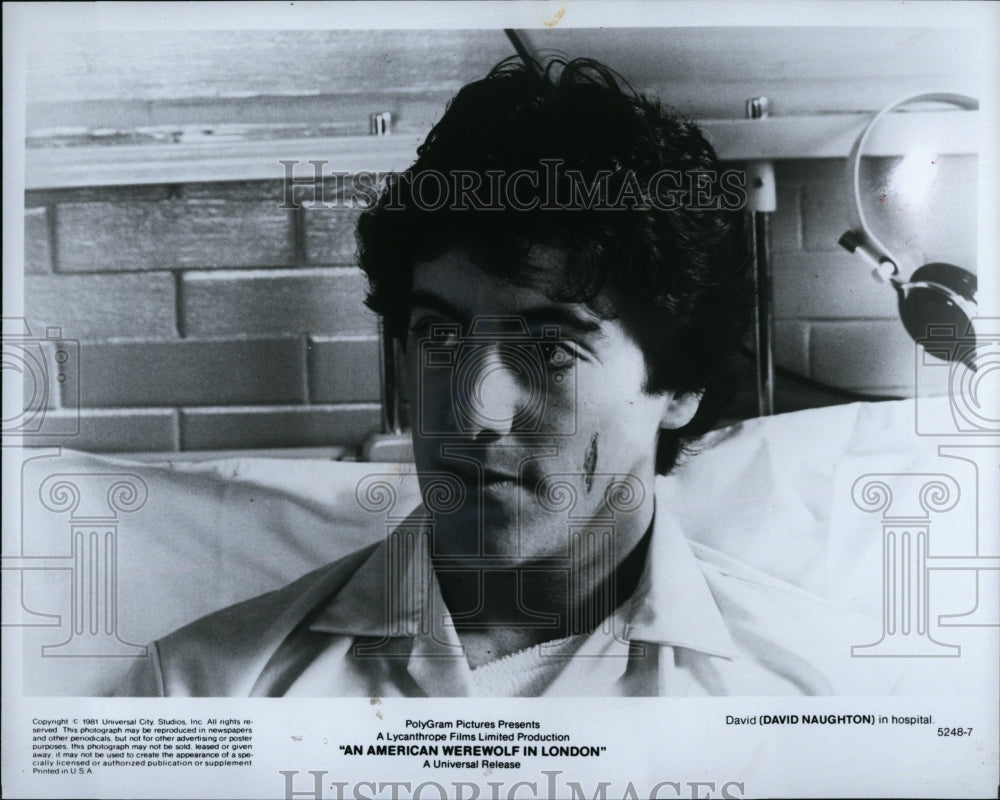 1981 Press Photo David Naughton Actor An American Werewolf In London Film Movie- Historic Images