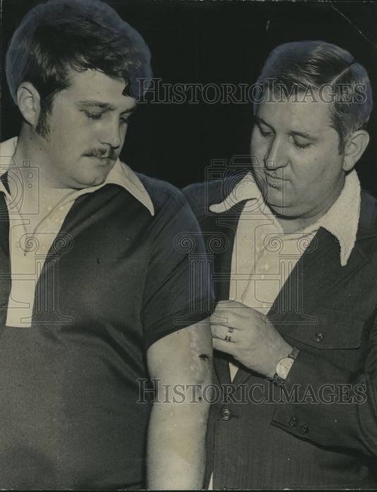 1973 Press Photo Birmingham Police Chief James Parsons Check's Officer's Wound- Historic Images