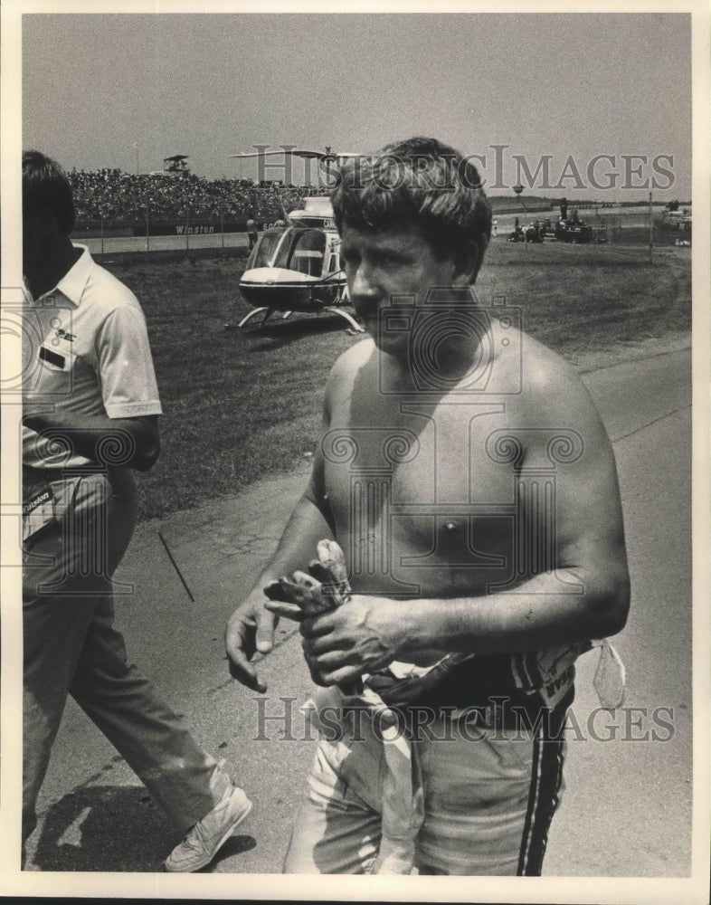 1987 Press Photo Auto Racing&#39;s Neil Bonnett After Indianapolis 500 Accident - Historic Images