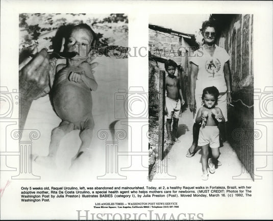 1992 Press Photo Raquel Urculino then and now photos after adoption- Historic Images