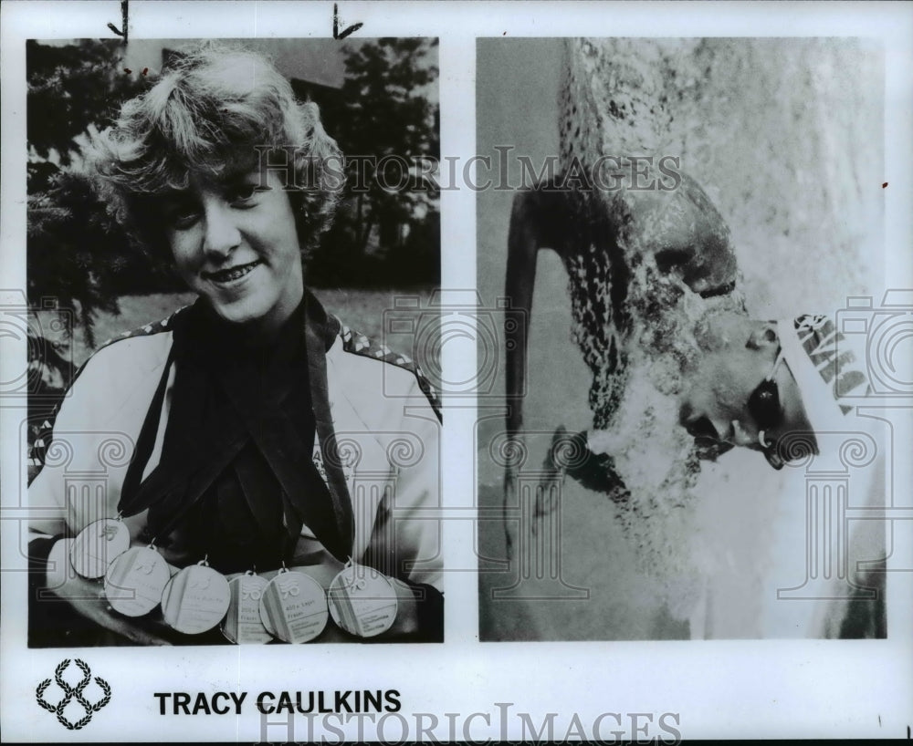 Press Photo: Tracy Caulkins - Swimming Medals - cvb49929- Historic Images