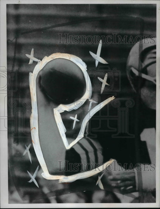 1966 Press Photo Football player Frank Ryan's elbow - cvb65391- Historic Images