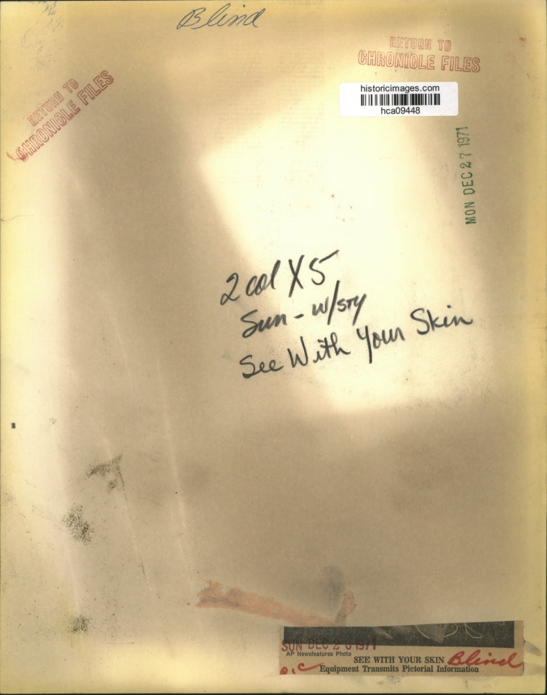 1971 Press Photo Doctor puts seeing equipment on the blind - hca09448