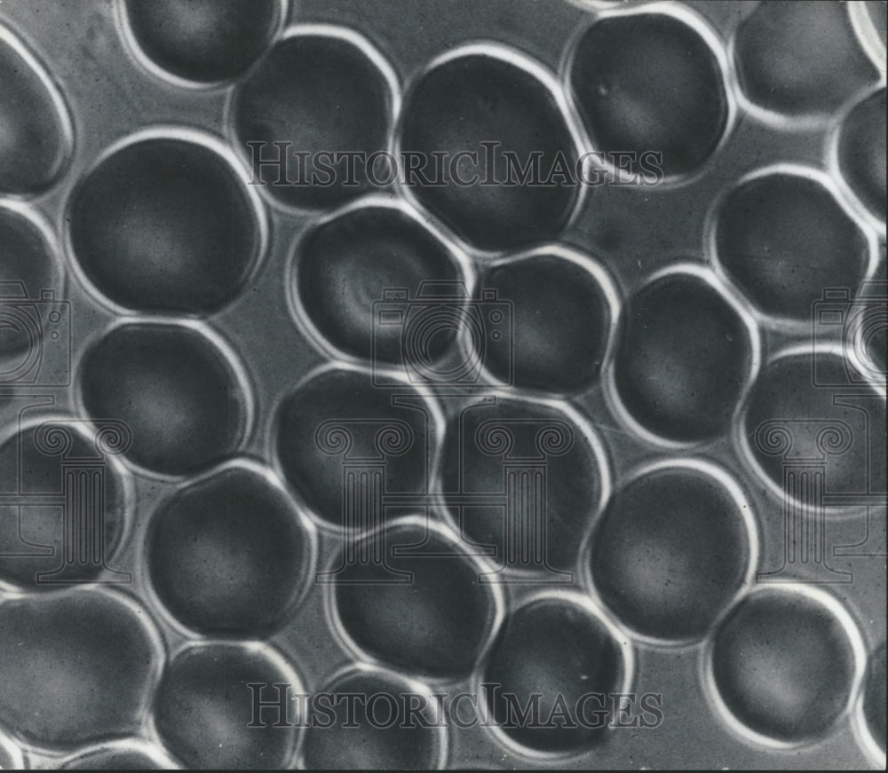 1974 Press Photo Human red blood cells - hca12801