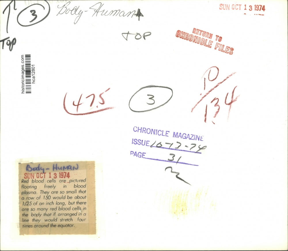 1974 Press Photo Human red blood cells - hca12801