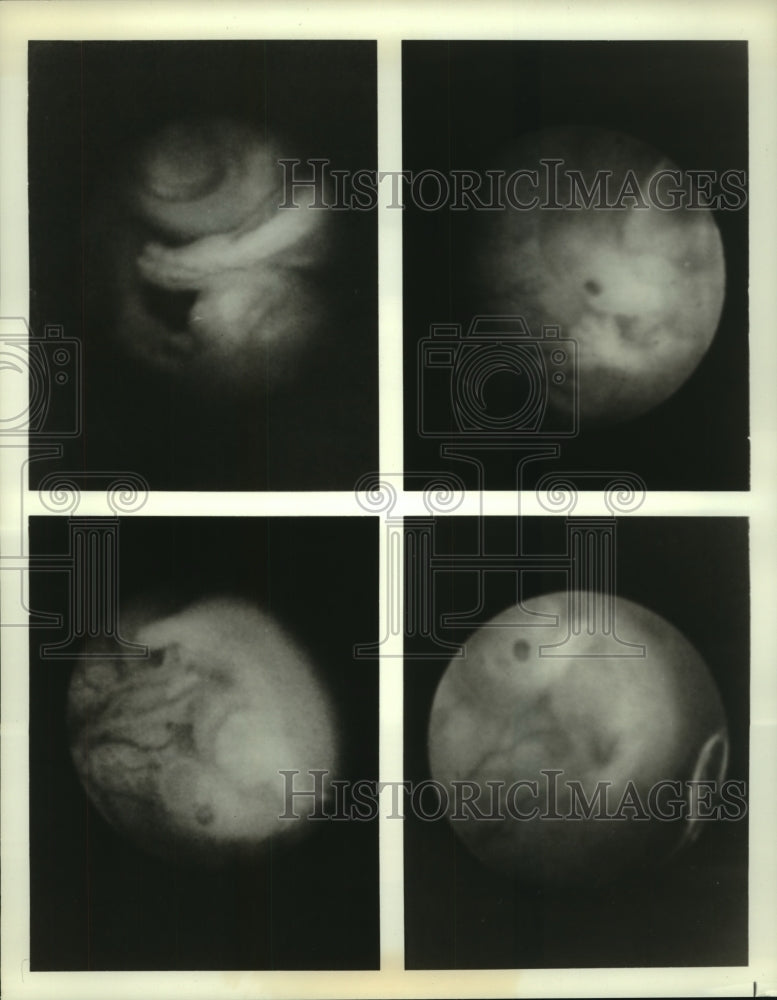 1978 Press Photo Views of an unborn fetus in "The Miracle Months" highlights- Historic Images