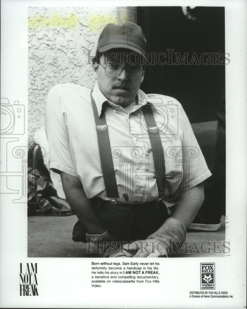 1988 Press Photo Sam Early, subject of the documentary &quot;I Am Not A Freak&quot;- Historic Images