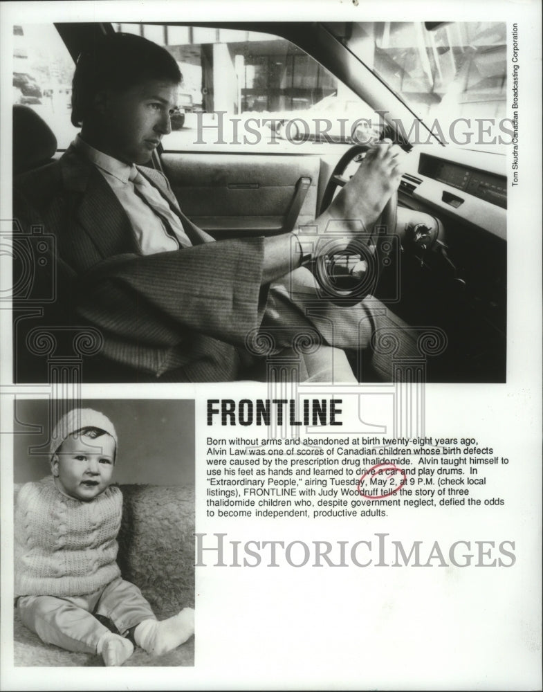 1989 Press Photo Alvin Law, a subject of the documentary &quot;Extraordinary People&quot;- Historic Images