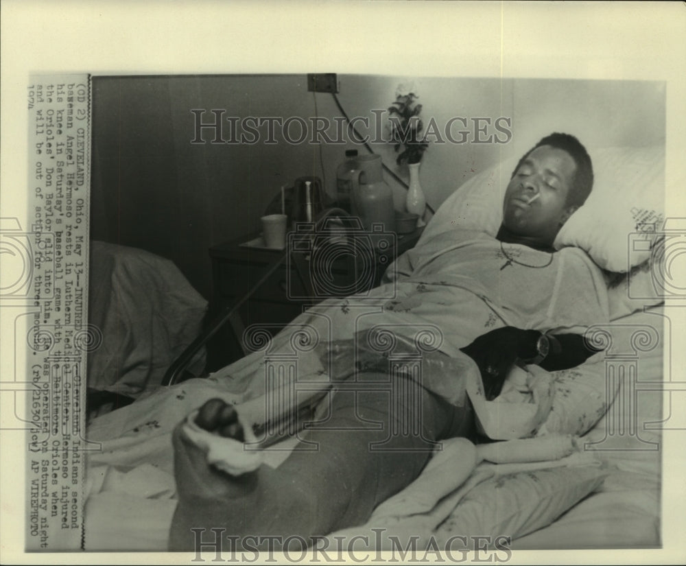 1974 Press Photo Cleveland Indians' Angel Hermoso recovers after knee surgery.- Historic Images