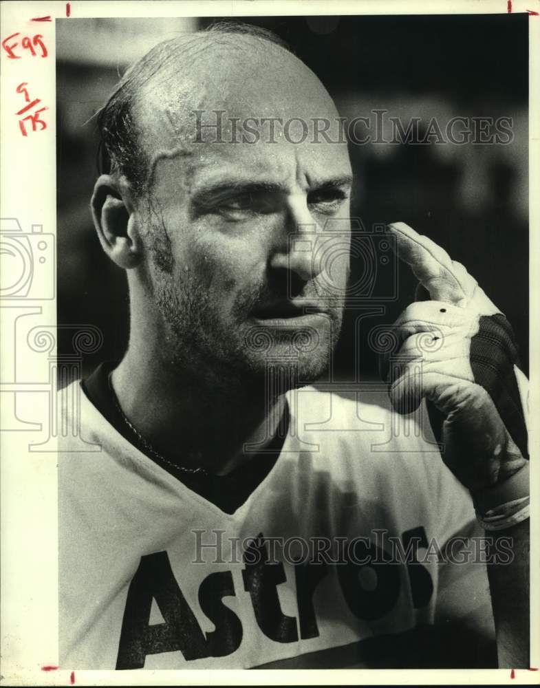 1980 Press Photo Astros' Art Howe points to where baseball hit him, breaking jaw- Historic Images