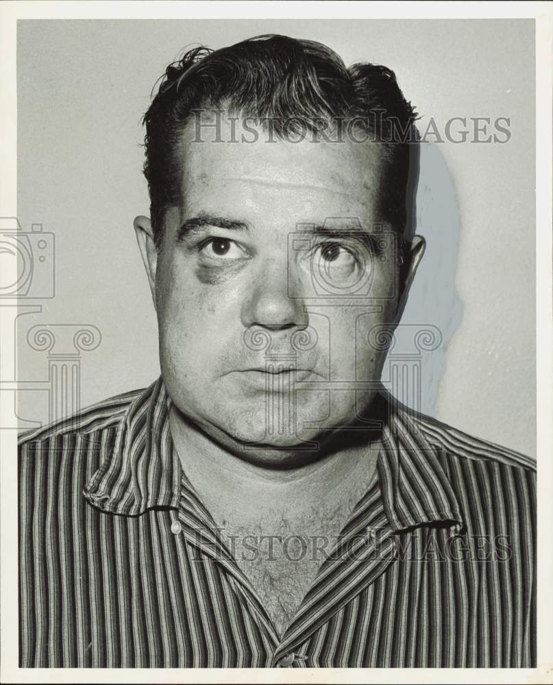 1960 Press Photo Earl Bickmore, longshoreman who was beaten in hotel room.- Historic Images