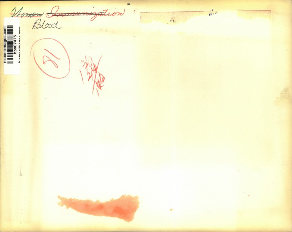 Press Photo Child cries while nurse takes blood sample. - hps07475