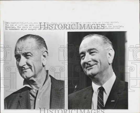 1965 Press Photo President Lyndon Johnson Before & After Surgery, Washington- Historic Images