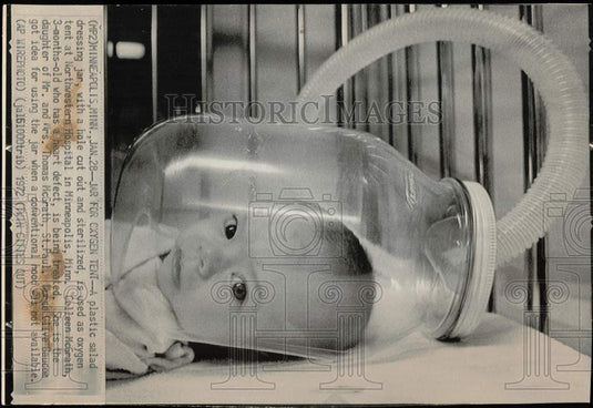 1972 Press Photo Jar Used as Oxygen Tent for Colleen McGrath in MN Hospital- Historic Images