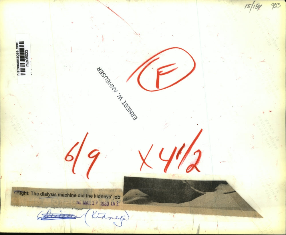 1980 Press Photo The dialysis machine did the kidney's job - mja06023