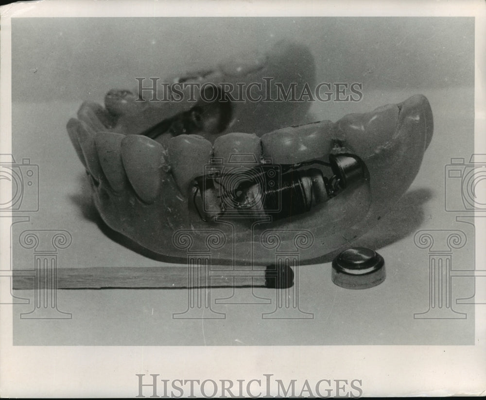 1964 Press Photo Transmitter inside Dentures - mja95444