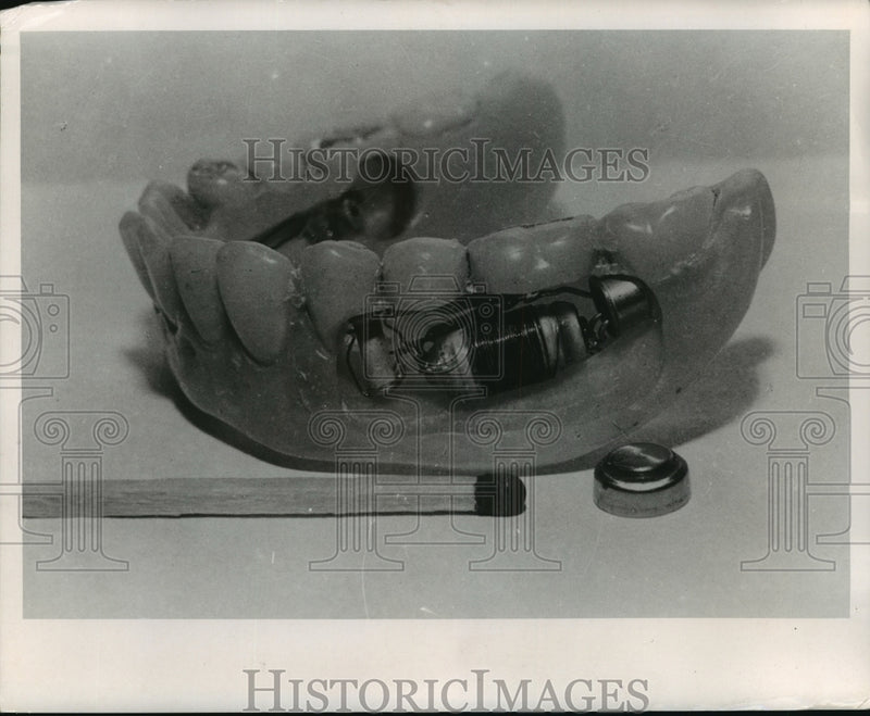 Load image into Gallery viewer, 1964 Press Photo Transmitter inside Dentures - mja95444
