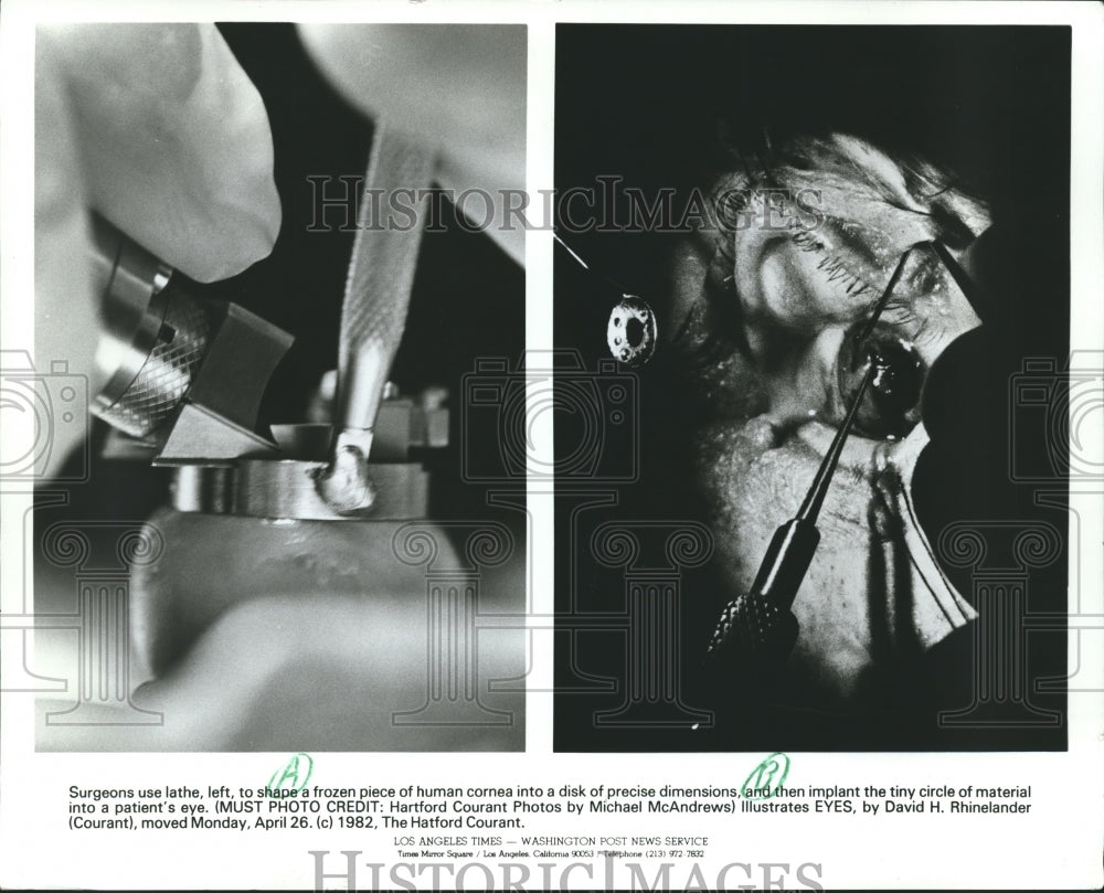 1982 Press Photo Surgeons shape frozen piece of cornea and implant into an eye- Historic Images