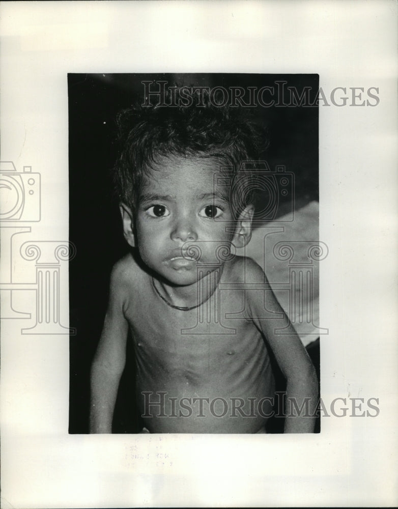 1972 Press Photo Calcutta, India Boy Admitted To Hospital- Historic Images