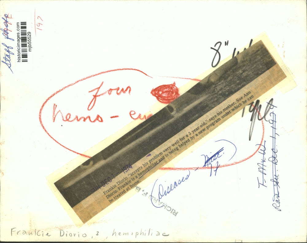 1974 Press Photo 3 year old hemophiliac Frankie Diorio helped by home treatment