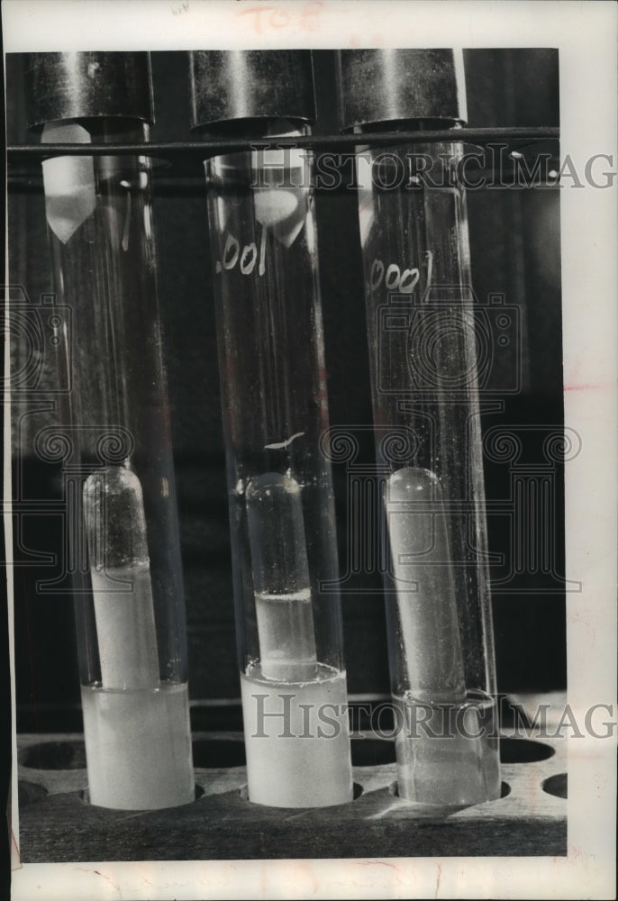 1962 Press Photo Culture Tubes Indicate Contamination In Milwaukee Beach Water- Historic Images