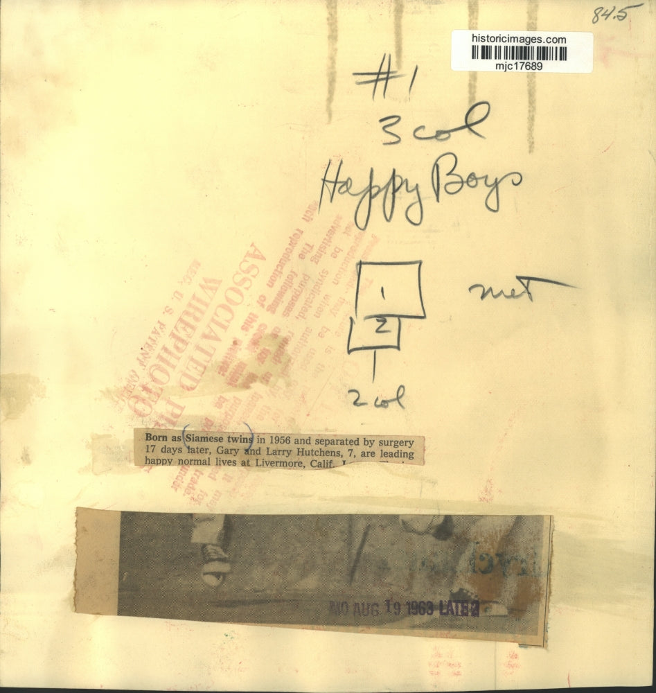 1963 Press Photo Siamese twins, Gary and Larry Hutchens, separated and healthy