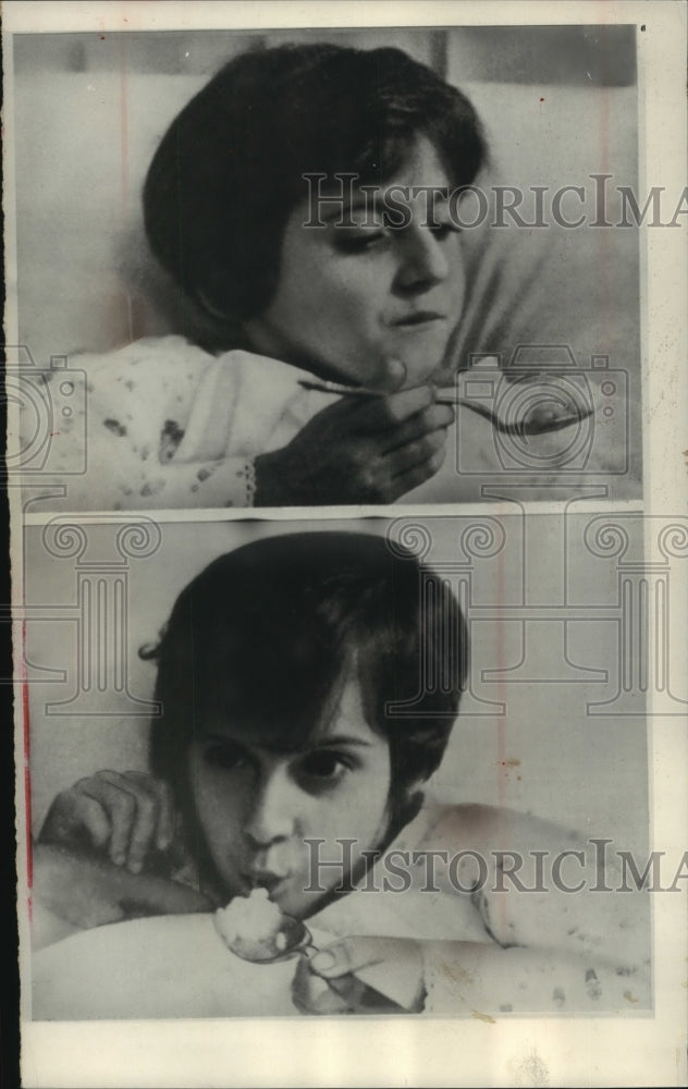 1965 Press Photo Siamese twins Maria Santina and Giuseppina Foglia, separated- Historic Images