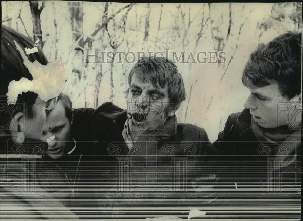 1969 Press Photo University of Wisconsin student bleeding after fight