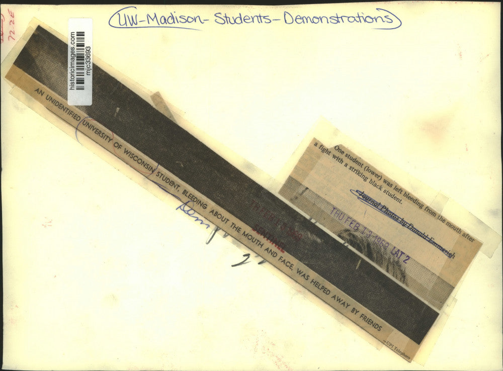 1969 Press Photo University of Wisconsin student bleeding after fight