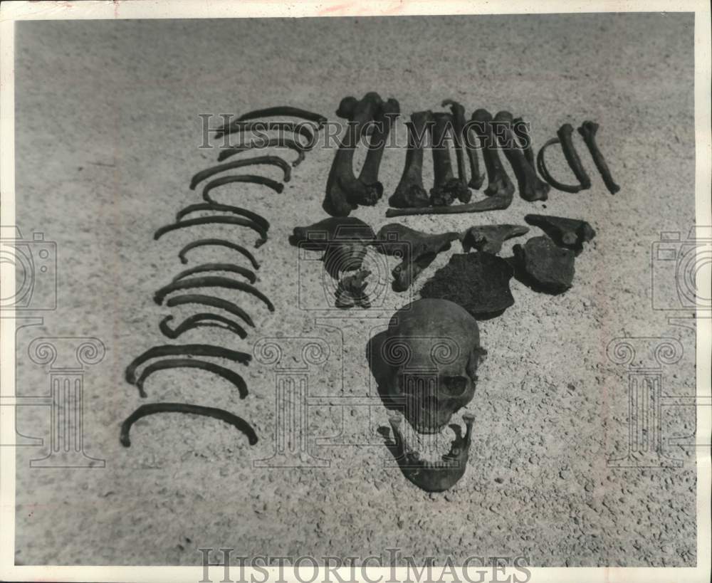 1964 Press Photo A skeleton found by a construction crew on a hill near Dundee - Historic Images