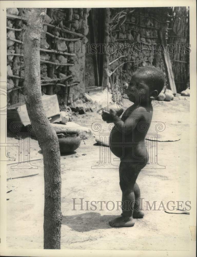 1966 Press Photo African Child with Bloated Belly, Tanganyika - mjc40643- Historic Images