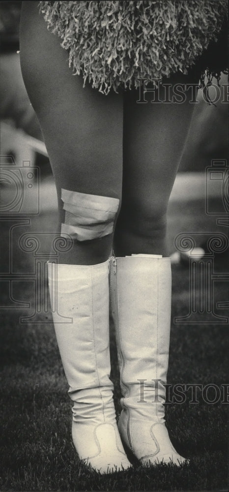1984 Press Photo Green Bay Packers cheerleader Cindy Fox's bandage covered knee- Historic Images