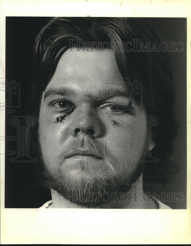 1980 Press Photo Carey Haworth After the Fight with Saginaw Hockey Players- Historic Images