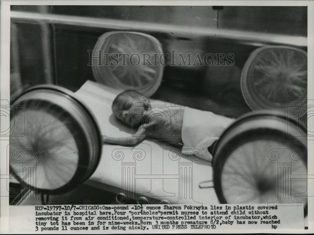 1953 Press Photo One pound -10- ounce baby, 3 months premature shown,Chicago- Historic Images