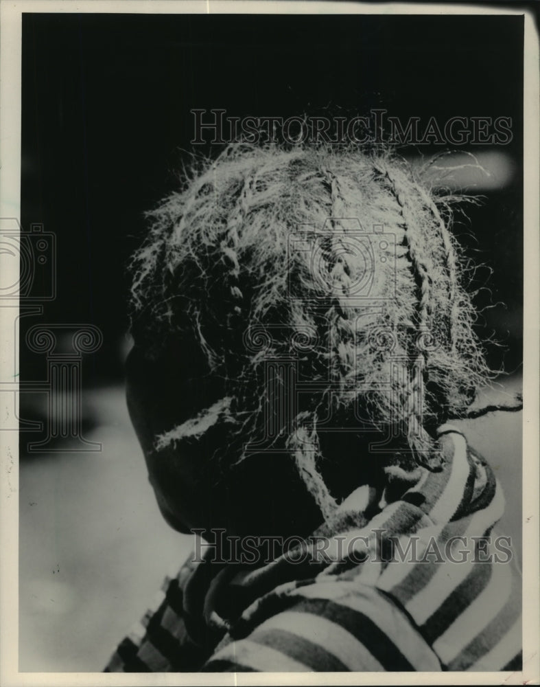 1985 Press Photo Braids in a woman&#39;s hair at River Hills Nursing Home- Historic Images