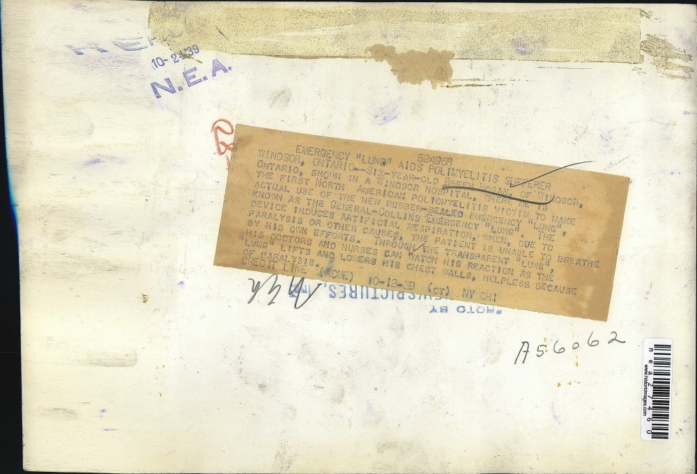 1939 Press Photo Breen Hogan Emergency Lung for Polimtelitis Condition