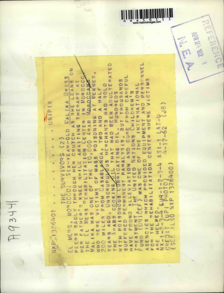 1962 Press Photo Malika Doiss looking through her crutch in Morocco rehab center