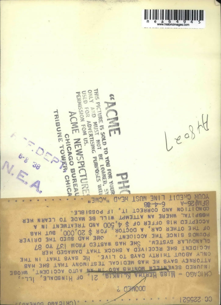 Load image into Gallery viewer, 1938 Press Photo Hertha Klinkig Suffered Damaged Glandular System
