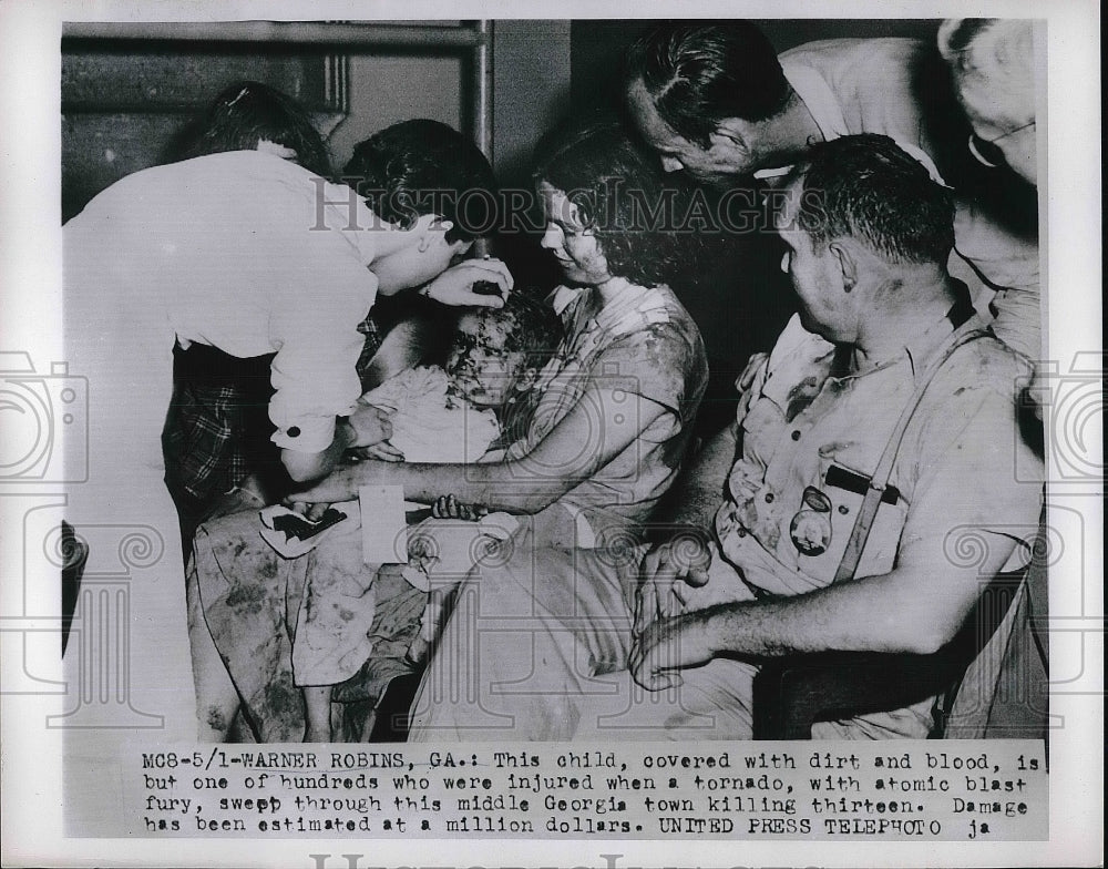 1953 Press Photo Child covered with dirt and blood injured by Tornado in Georgia