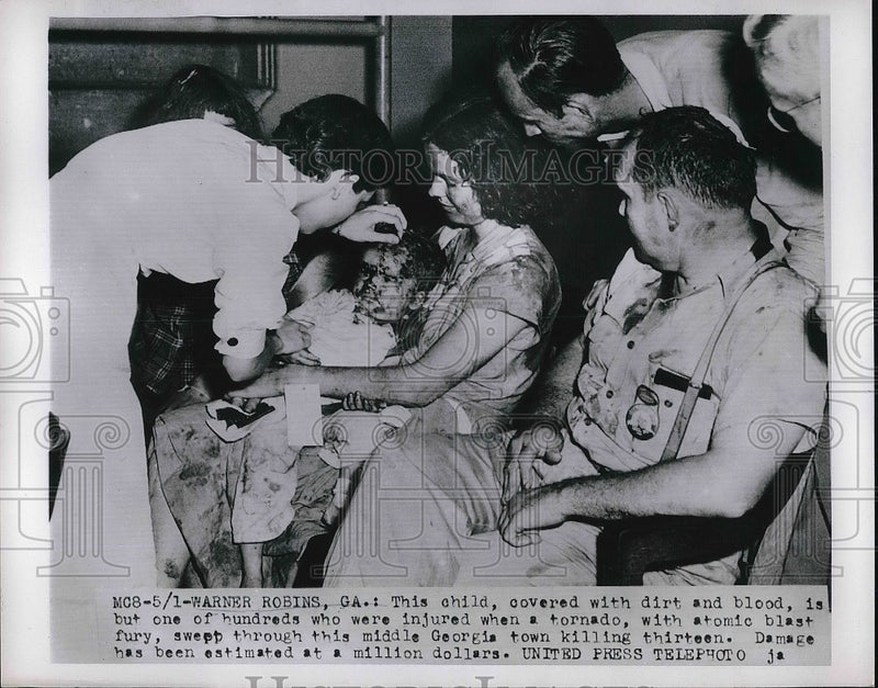 Load image into Gallery viewer, 1953 Press Photo Child covered with dirt and blood injured by Tornado in Georgia
