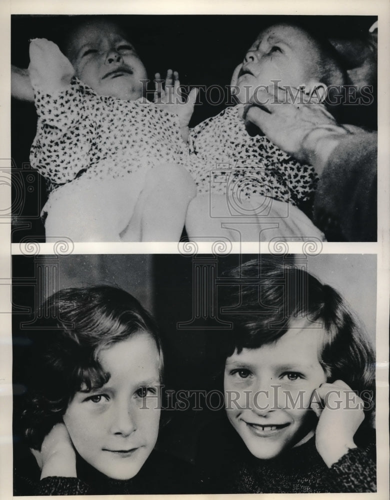 Load image into Gallery viewer, 1963 Press Photo Siamese twins Tjitske &amp; Folkje separated in Netherlands
