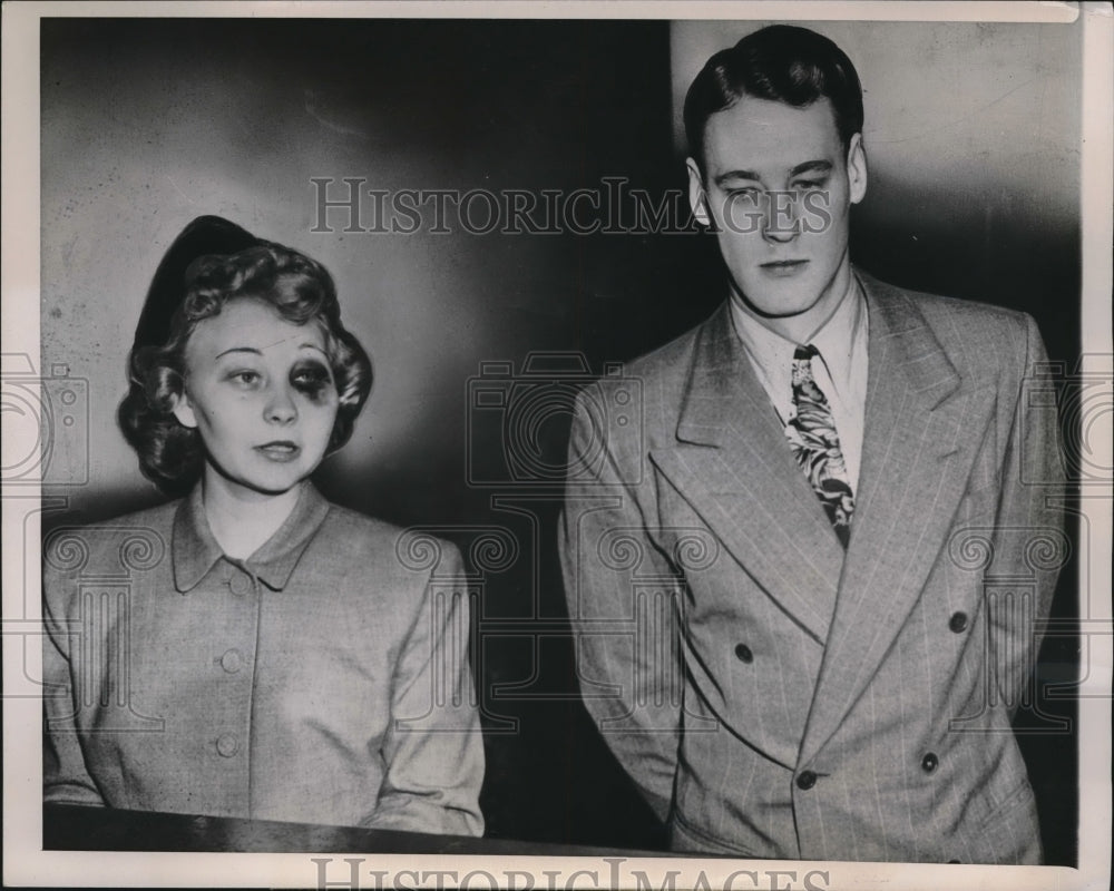 1948 Press Photo Chicago, Mrs Lillian Youngblood, assaulted by husband William