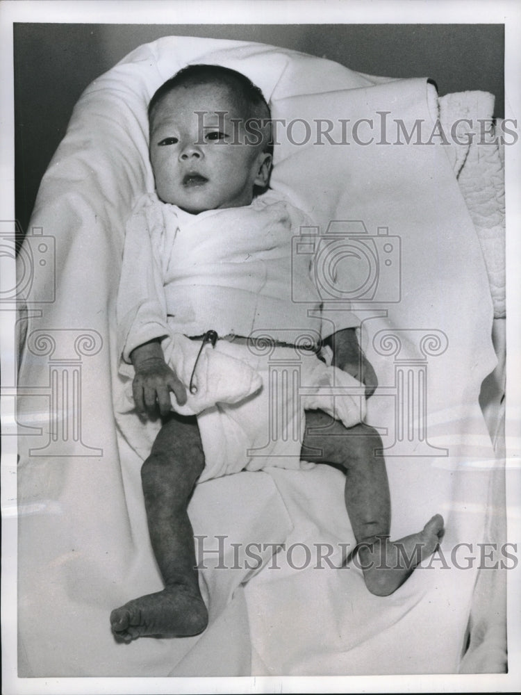 1958 Press Photo Sharon Kei Tatai After Operations for Stomach &amp; Esophagus - Historic Images