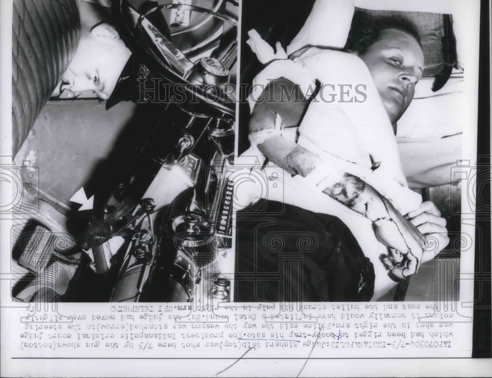 1961 Press Photo Judge Richard Salb shot in right arm. his car was booby-trapped