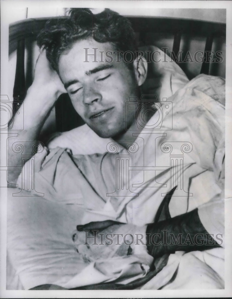 1949 Press Photo Logan Riggs With Burned Hand From Fire at Univ. Oklahoma Dorm- Historic Images